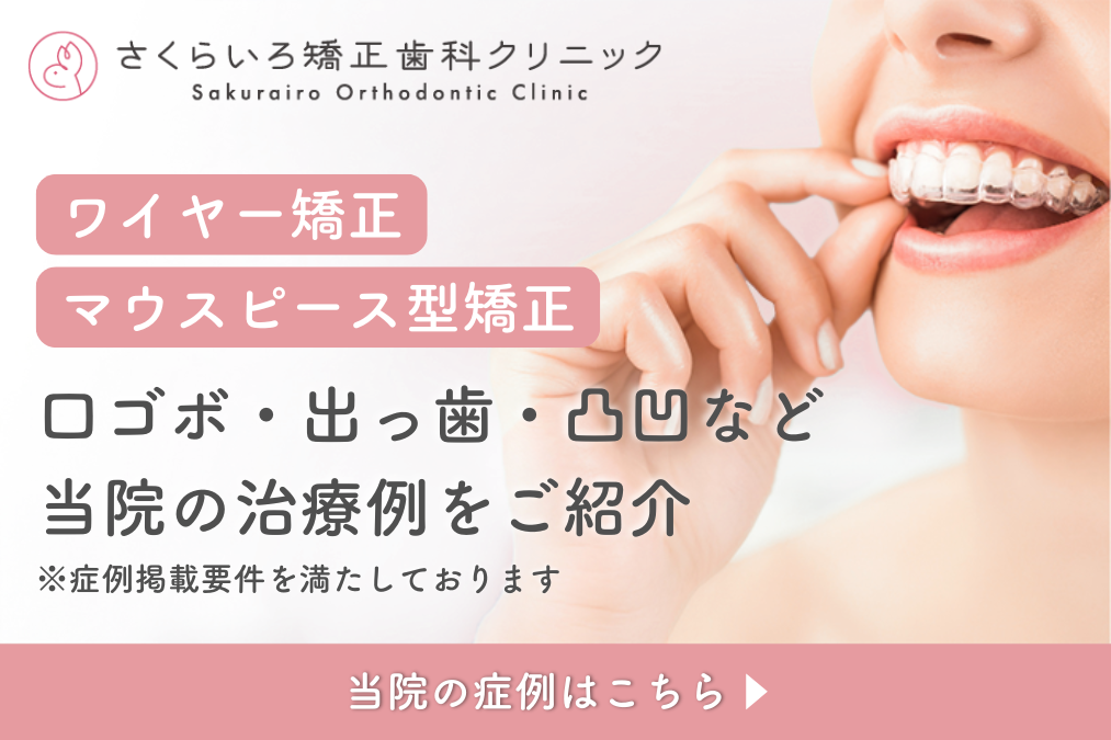 矯正治療の症例紹介